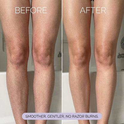 Brivia™ Hair Removal Mousse