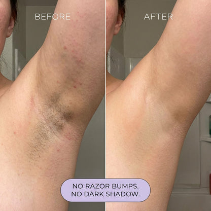Brivia™ Hair Removal Mousse