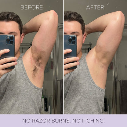 Brivia™ Hair Removal Mousse